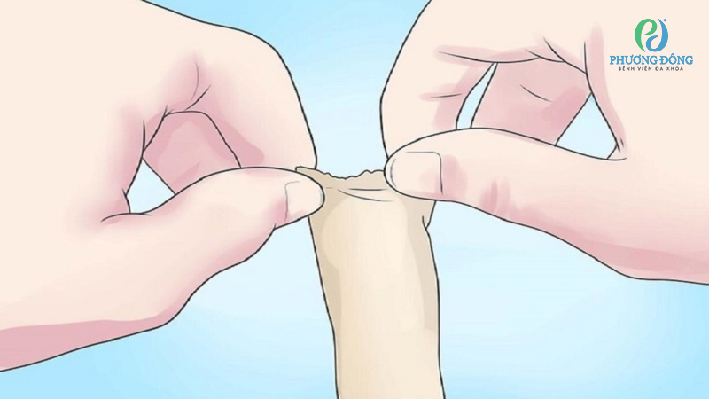 Chuyên gia giải đáp từng nào tuổi thì lột bao quy đầu Chuyên gia giải đáp bao nhiêu tuổi thì lột bao quy đầu