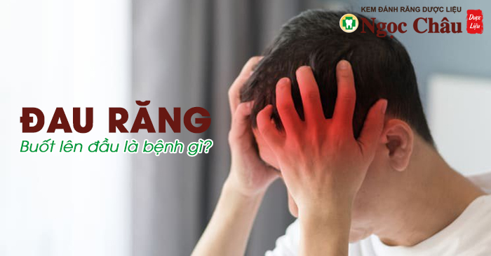 Đau nhức răng buốt lên đầu là tín hiệu của dịch gì